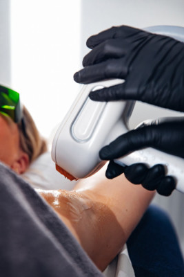 Image 3 from Venus Epileve - Diode Laser | Sarah Dale Aesthetics