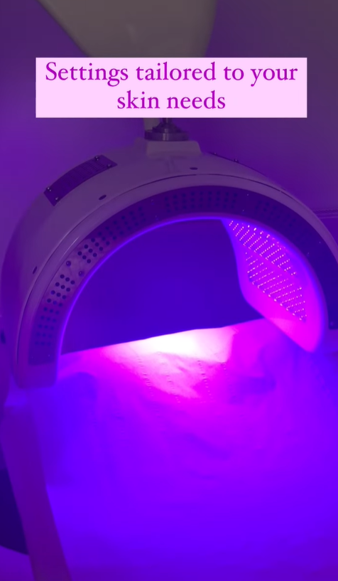 Image 6 from Superderm Facial | Sarah Dale Aesthetics