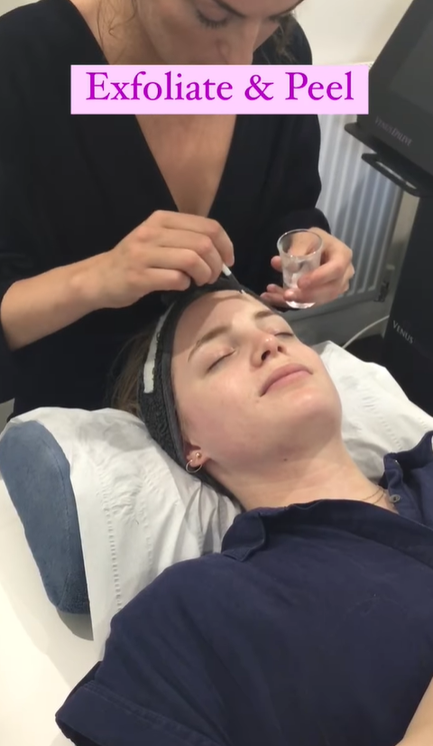 Image 2 from Superderm Facial | Sarah Dale Aesthetics